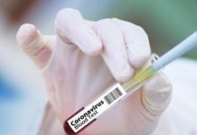 Morti in Piemonte per coronavirus, esposto del Codacons in Procura
