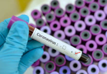 Coronavirus – Ancora una giornata senza decessi a Vercelli e due soli contagi